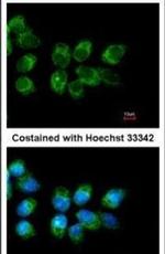 Folate Receptor alpha Antibody in Immunocytochemistry (ICC/IF)