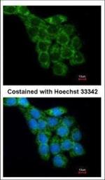 RPL8 Antibody in Immunocytochemistry (ICC/IF)