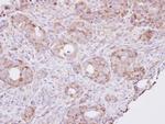 RPL8 Antibody in Immunohistochemistry (Paraffin) (IHC (P))