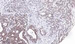 UBE2M Polyclonal Antibody
