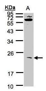 UBE2M Antibody in Western Blot (WB)