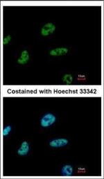CHD4 Polyclonal Antibody