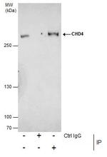 CHD4 Antibody in Immunoprecipitation (IP)
