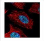 alpha Actinin 4 Polyclonal Antibody