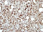 RING1 Polyclonal Antibody