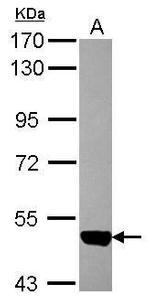 ACVRL1 Polyclonal Antibody