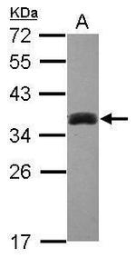 SULT1A3 Polyclonal Antibody