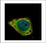 GRK2 Polyclonal Antibody