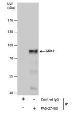 GRK2 Antibody in Immunoprecipitation (IP)
