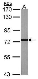 GRK2 Antibody in Western Blot (WB)
