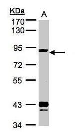 GRK2 Antibody in Western Blot (WB)