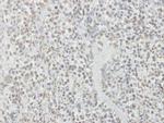 SDHA Antibody in Immunohistochemistry (Paraffin) (IHC (P))
