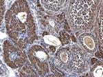 SDHA Antibody in Immunohistochemistry (Paraffin) (IHC (P))