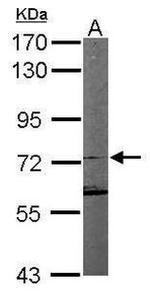 SDHA Antibody in Western Blot (WB)
