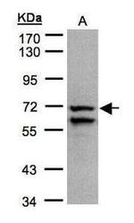 SDHA Antibody in Western Blot (WB)