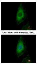 PP2A beta Polyclonal Antibody