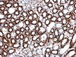 ILK Polyclonal Antibody