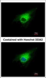 PGD Polyclonal Antibody