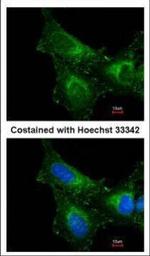 PRDX1 Antibody in Immunocytochemistry (ICC/IF)
