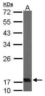 NME2 Antibody in Western Blot (WB)