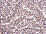 Cytochrome C1 Polyclonal Antibody