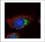 HGS Polyclonal Antibody