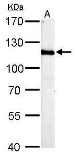 HGS Antibody in Western Blot (WB)