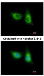 SOS2 Polyclonal Antibody