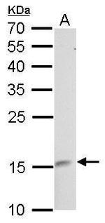 LMO1 Antibody in Western Blot (WB)