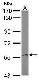 IMPDH2 Polyclonal Antibody