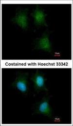 IFITM1 Antibody in Immunocytochemistry (ICC/IF)