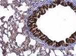 GDI1 Antibody in Immunohistochemistry (Paraffin) (IHC (P))