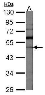 GDI1 Antibody in Western Blot (WB)