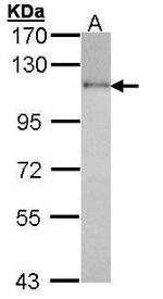 HGS Antibody in Western Blot (WB)
