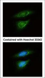 LDHB Polyclonal Antibody