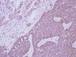 ARHGEF7 Antibody in Immunohistochemistry (Paraffin) (IHC (P))