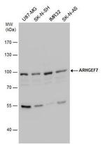 ARHGEF7 Antibody in Western Blot (WB)