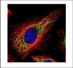 TUFM Polyclonal Antibody