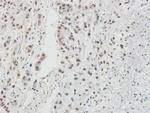 RPA2 Antibody in Immunohistochemistry (Paraffin) (IHC (P))