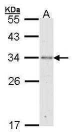 RPA2 Antibody in Western Blot (WB)