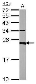 CD81 Antibody in Western Blot (WB)