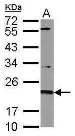 CD81 Antibody in Western Blot (WB)