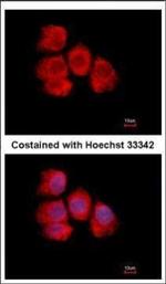 IMPDH2 Antibody in Immunocytochemistry (ICC/IF)