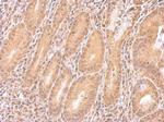 IMPDH2 Antibody in Immunohistochemistry (Paraffin) (IHC (P))