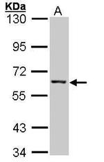 IMPDH2 Antibody in Western Blot (WB)