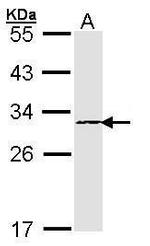 PSMB4 Polyclonal Antibody