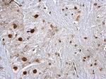 hnRNP K Antibody in Immunohistochemistry (Paraffin) (IHC (P))