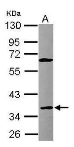 CD23 Antibody in Western Blot (WB)