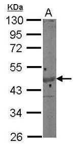 gamma Actin Polyclonal Antibody