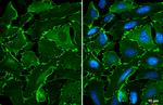 EPB41L3 Polyclonal Antibody